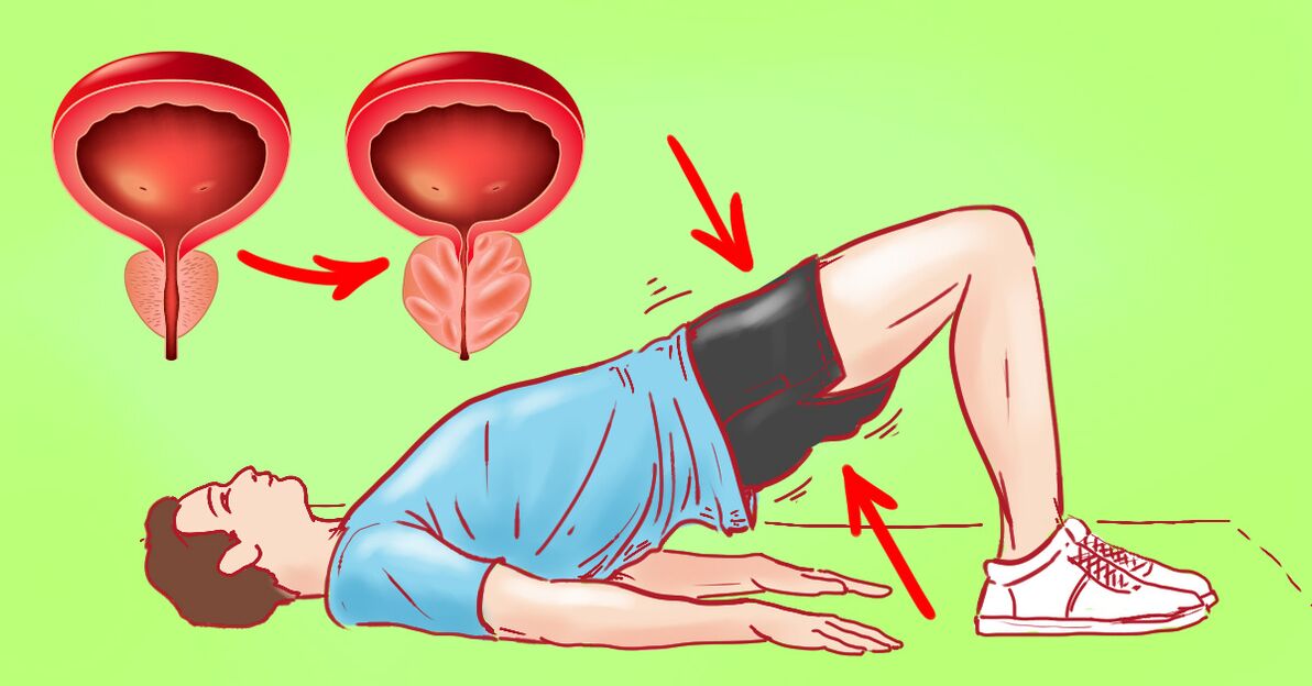 Exercicios terapéuticos para a prostatite crónica